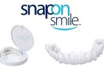 اسنپ آن اسمایل (لمینیت متحرک) snap on smile